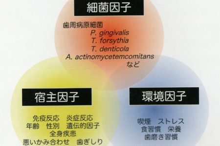 歯周病について、ご存じですか?